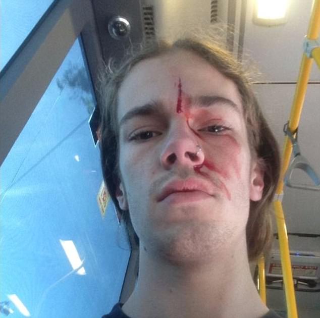 44389E5800000578-4886028-A_man_accused_of_punching_Kevin_Rudd_s_godson_in_the_face_during-a-1_1505428675817.jpg