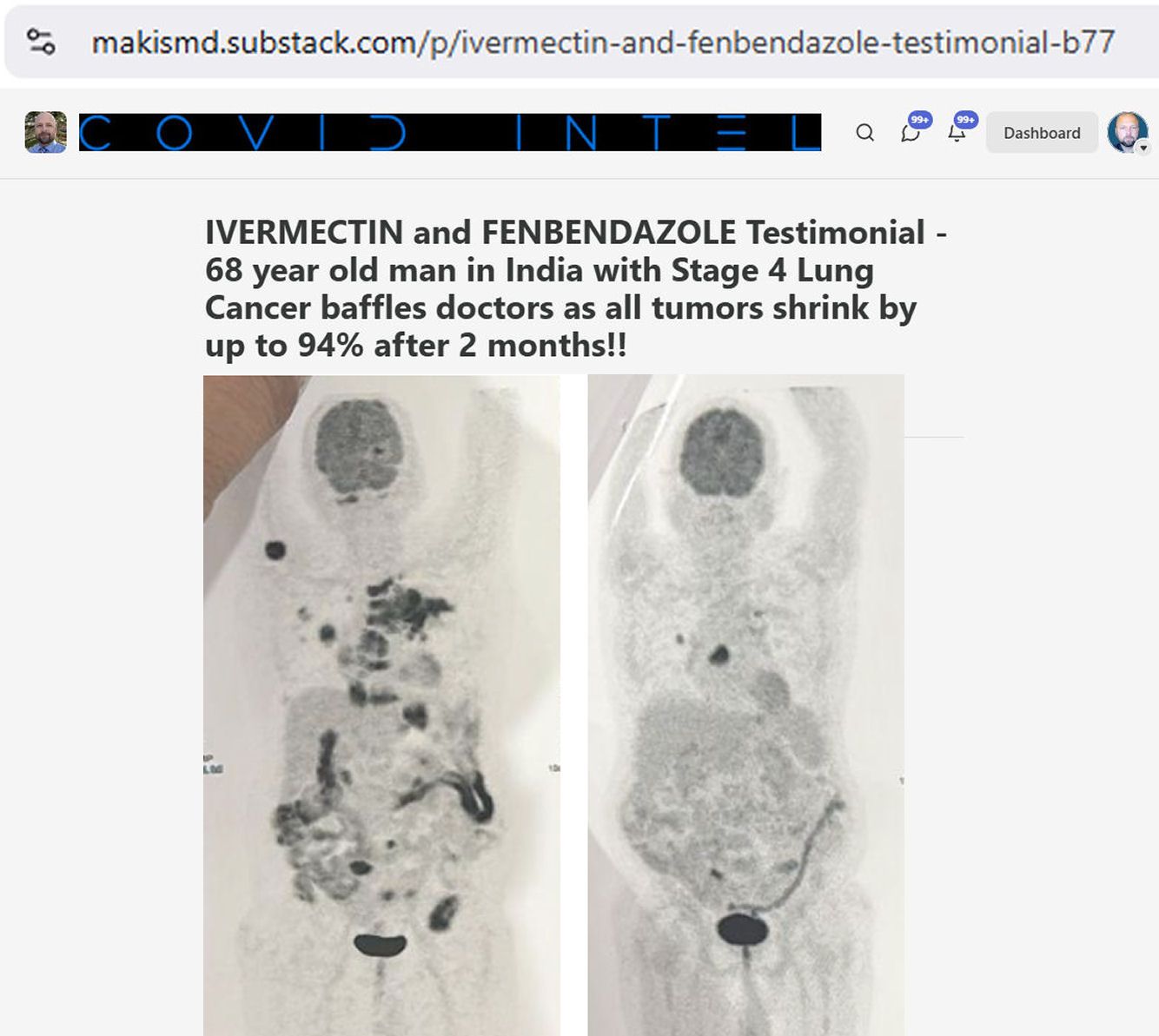 ivermectin_fenbend.jpg