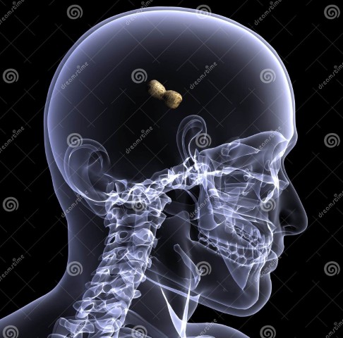 skeleton-x-ray-peanut-brain-1-24650680-2540385126.jpg
